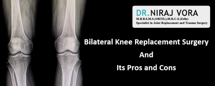 Bilateral Knee Replacement Surgery